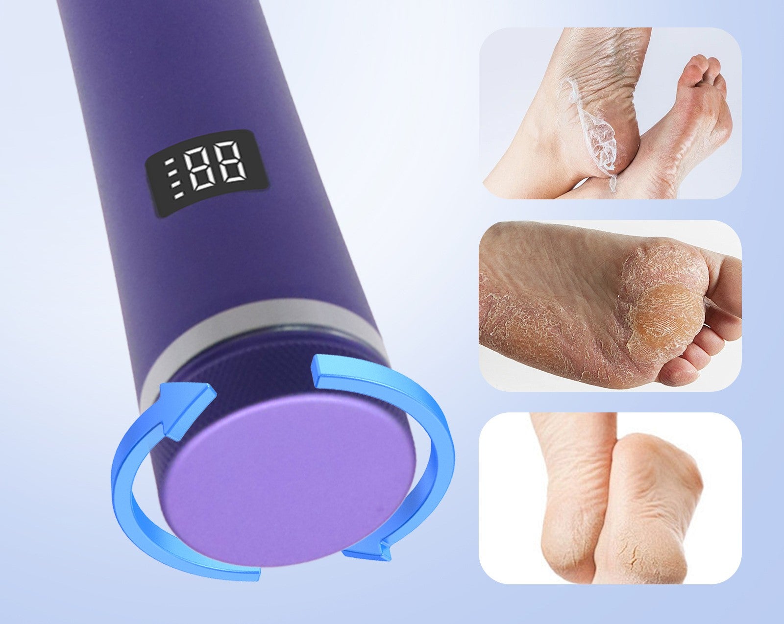 Rimuovi Calli Elettrico SoftHeel Pro